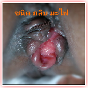 ลักษณะของโรค 2