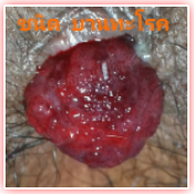 ลักษณะของโรค 4