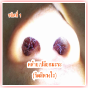 ลักษณะของโรค 1