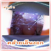 ลักษณะของโรค 2