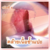 ภาพ 4